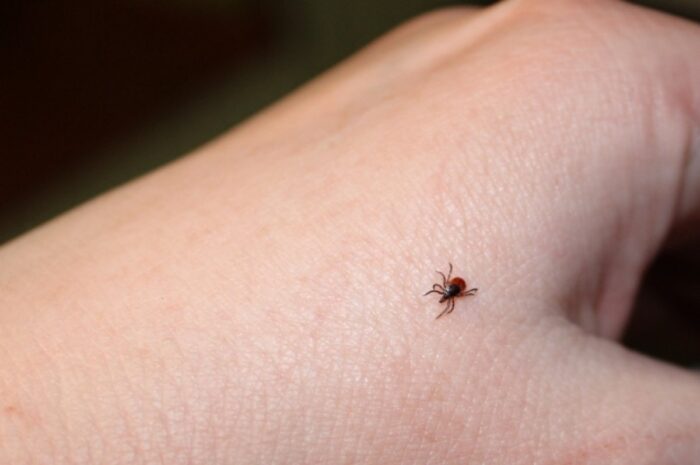 175 тысяч россиян пострадали от присасываний клещей