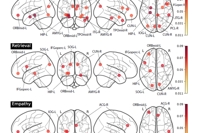 Нейроны в мозгах либералов и консерваторов ведут себя по-разному
