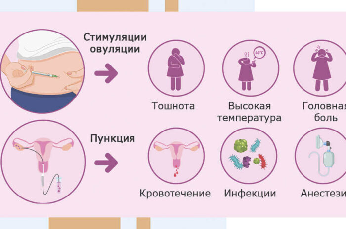 Опасно ли быть донором яйцеклетки