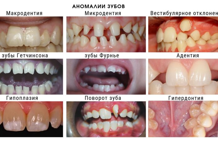 Ортодонты исправляют сложные проблемы