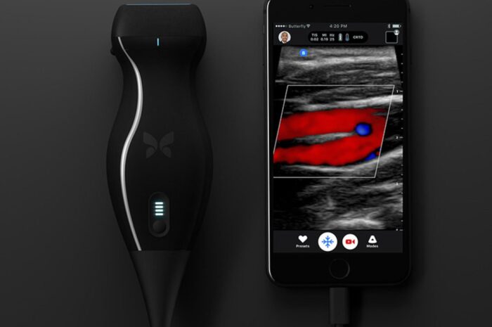 Разработан самый портативный и самый дешевый аппарат УЗИ