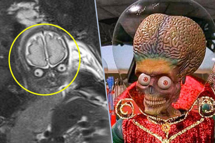 Родители испугались скана МРТ своего ребёнка, который находился в утробе