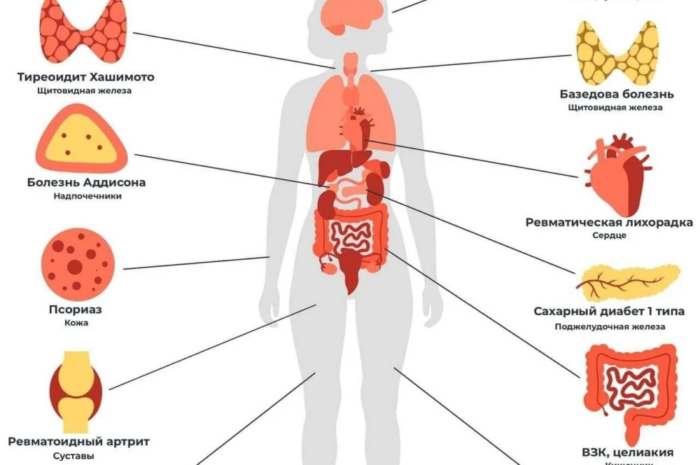 Витамин D и лишний вес тесно взаимосвязаны