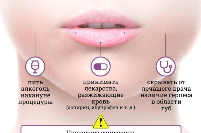 Все больше дам предпочитает увеличивать губы